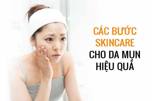 Tìm hiểu về da dầu mụn