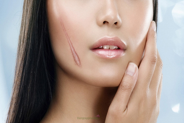 Những sai lầm thường gặp khi sử dụng peeling gel