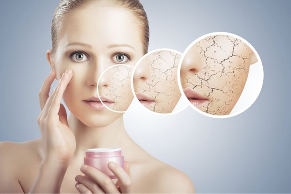 cách chăm sóc da mặt khô tại nhà